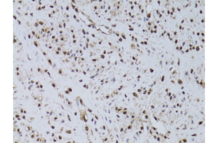 Immunohistochemistry - Anti-HUS1 Antibody (A89241) - Antibodies.com