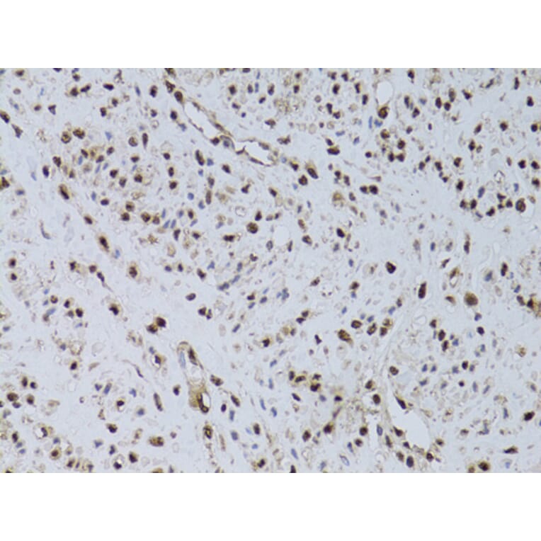 Immunohistochemistry - Anti-HUS1 Antibody (A89241) - Antibodies.com