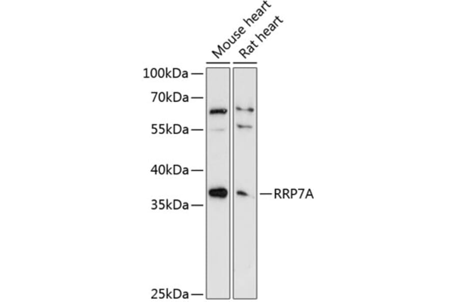 Western Blot - Anti-RRP7A Antibody (A89242) - Antibodies.com