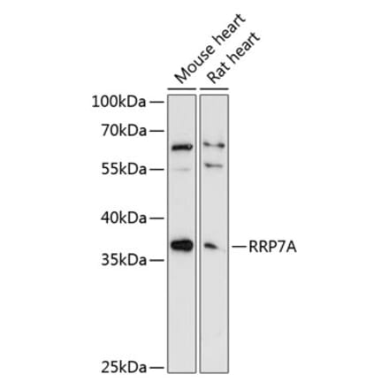 Western Blot - Anti-RRP7A Antibody (A89242) - Antibodies.com