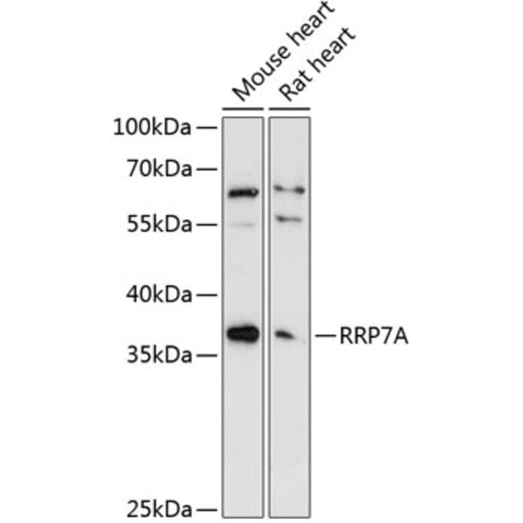 Western Blot - Anti-RRP7A Antibody (A89242) - Antibodies.com