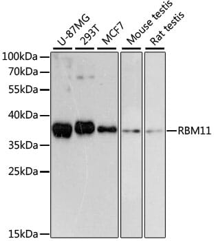 Western blot analysis of extracts of various cell lines, using Anti-RBM11 Antibody (A13216) at 1:3000 dilution.
Secondary antibody: Goat Anti-Rabbit IgG (H+L) (HRP) (AS014) at 1:10,000 dilution.
Lysates / proteins: 25µg per lane.
Blocking buffer: 3% non-fat dry milk in TBST.
Detection: ECL Basic Kit (RM00020).
Exposure time: 90s.