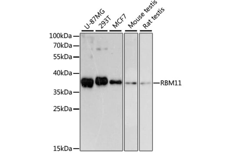 Western Blot - Anti-RBM11 Antibody (A89243) - Antibodies.com