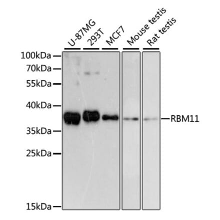 Western Blot - Anti-RBM11 Antibody (A89243) - Antibodies.com