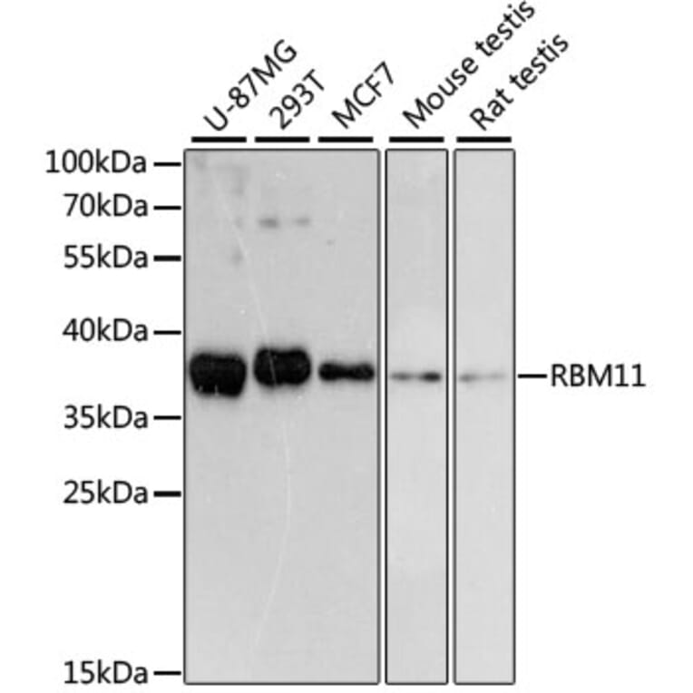 Western Blot - Anti-RBM11 Antibody (A89243) - Antibodies.com