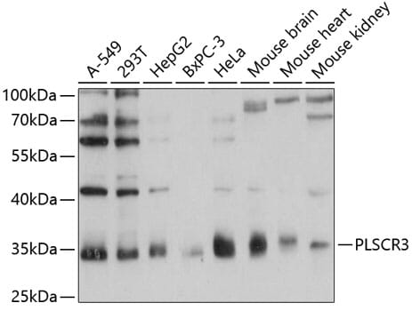 Western blot analysis of extracts of various cell lines, using Anti-PLSCR3 Antibody (A12371) at 1:1,000 dilution.
Secondary antibody: Goat Anti-Rabbit IgG (H+L) (HRP) (AS014) at 1:10,000 dilution.
Lysates / proteins: 25µg per lane.
Blocking buffer: 3% non-fat dry milk in TBST.
Detection: ECL Basic Kit (RM00020).
Exposure time: 1s.
