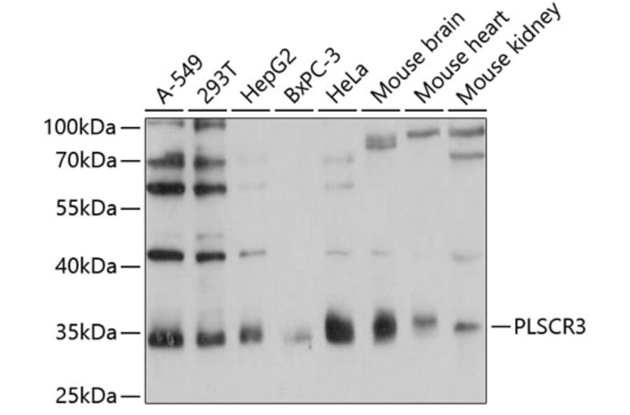 Western Blot - Anti-PLSCR3 Antibody (A89244) - Antibodies.com