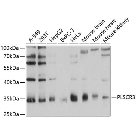 Western Blot - Anti-PLSCR3 Antibody (A89244) - Antibodies.com