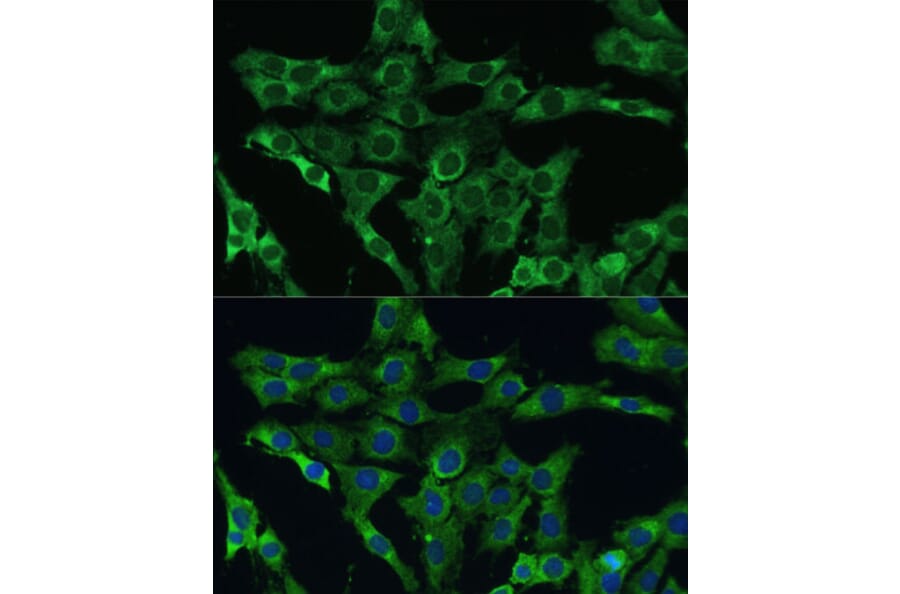 Immunofluorescence - Anti-PLSCR3 Antibody (A89244) - Antibodies.com