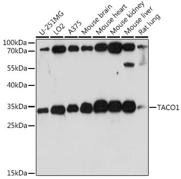 Western blot analysis of extracts of various cell lines, using Anti-TACO1 Antibody (A15445) at 1:1,000 dilution.
Secondary antibody: Goat Anti-Rabbit IgG (H+L) (HRP) (AS014) at 1:10,000 dilution.
Lysates / proteins: 25µg per lane.
Blocking buffer: 3% non-fat dry milk in TBST.
Detection: ECL Basic Kit (RM00020).
Exposure time: 90s.