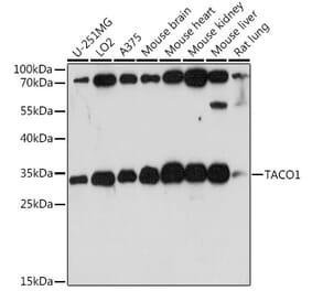 Western Blot - Anti-FLJ36733 Antibody (A89245) - Antibodies.com