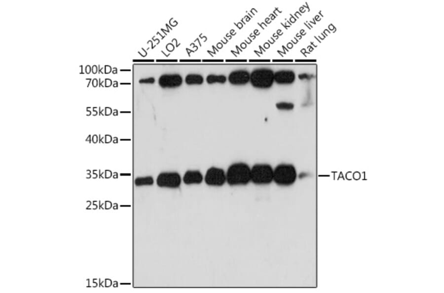 Western Blot - Anti-FLJ36733 Antibody (A89245) - Antibodies.com