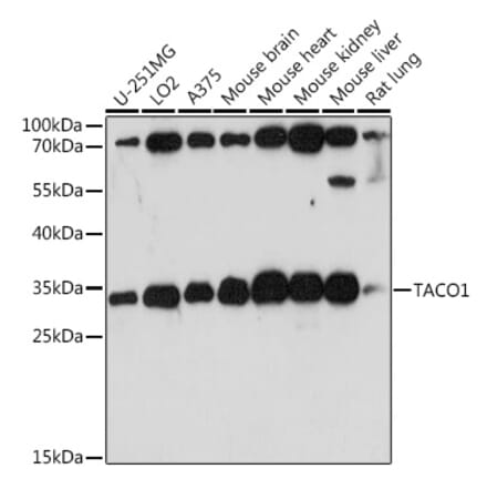 Western Blot - Anti-FLJ36733 Antibody (A89245) - Antibodies.com