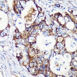 Immunohistochemistry - Anti-FLJ36733 Antibody (A89245) - Antibodies.com