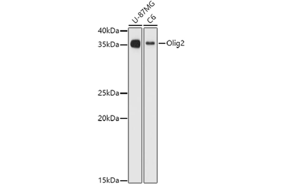 Western Blot - Anti-Olig2 Antibody (A89247) - Antibodies.com