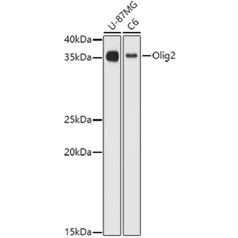 Western Blot - Anti-Olig2 Antibody (A89247) - Antibodies.com