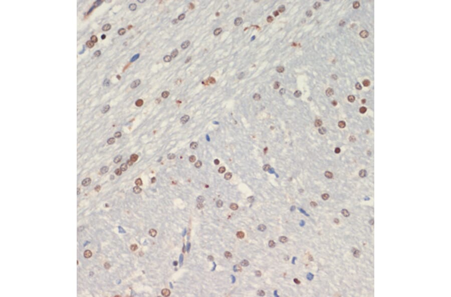 Immunohistochemistry - Anti-Olig2 Antibody (A89247) - Antibodies.com