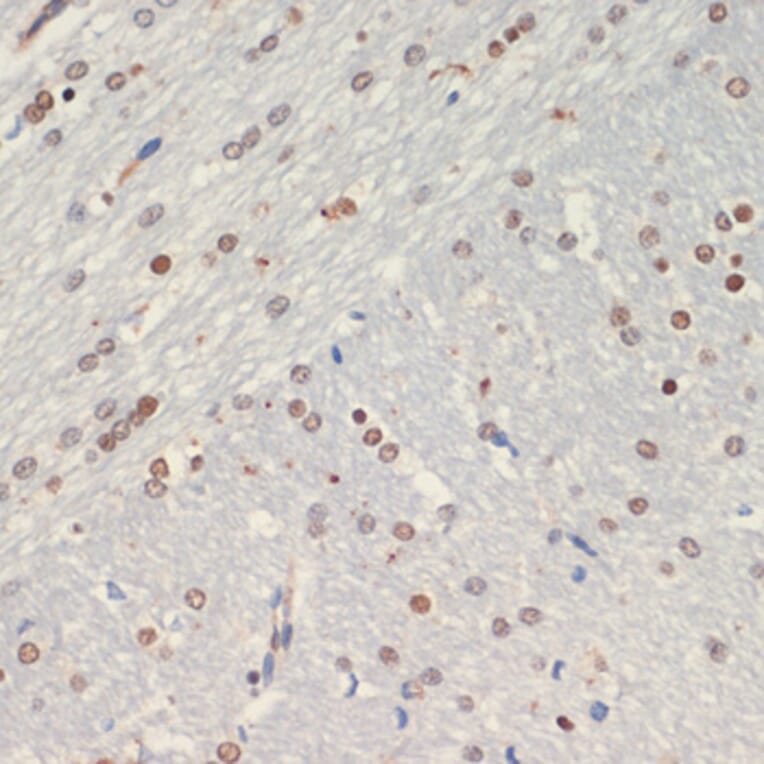 Immunohistochemistry - Anti-Olig2 Antibody (A89247) - Antibodies.com
