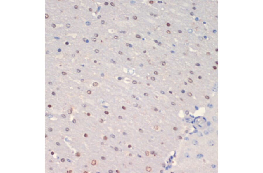 Immunohistochemistry - Anti-Olig2 Antibody (A89247) - Antibodies.com