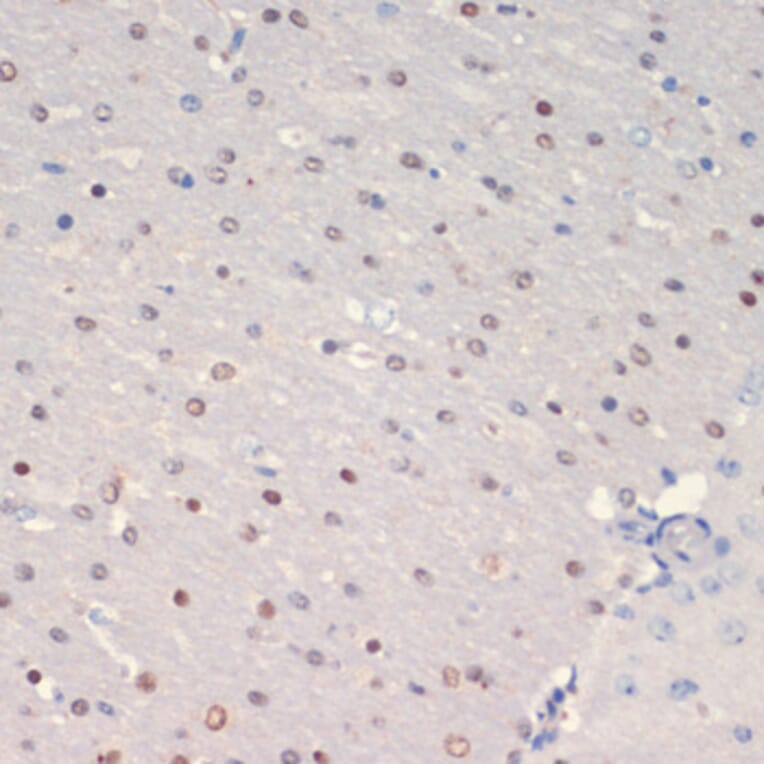 Immunohistochemistry - Anti-Olig2 Antibody (A89247) - Antibodies.com