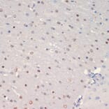 Immunohistochemistry - Anti-Olig2 Antibody (A89247) - Antibodies.com
