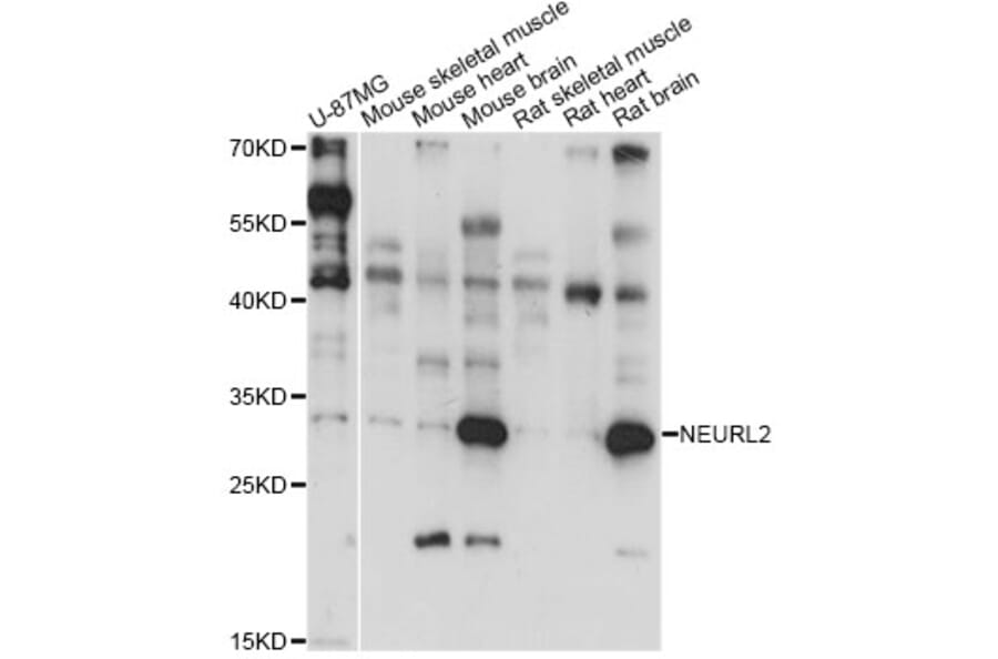 Western Blot - Anti-NEURL2 Antibody (A14450) - Antibodies.com