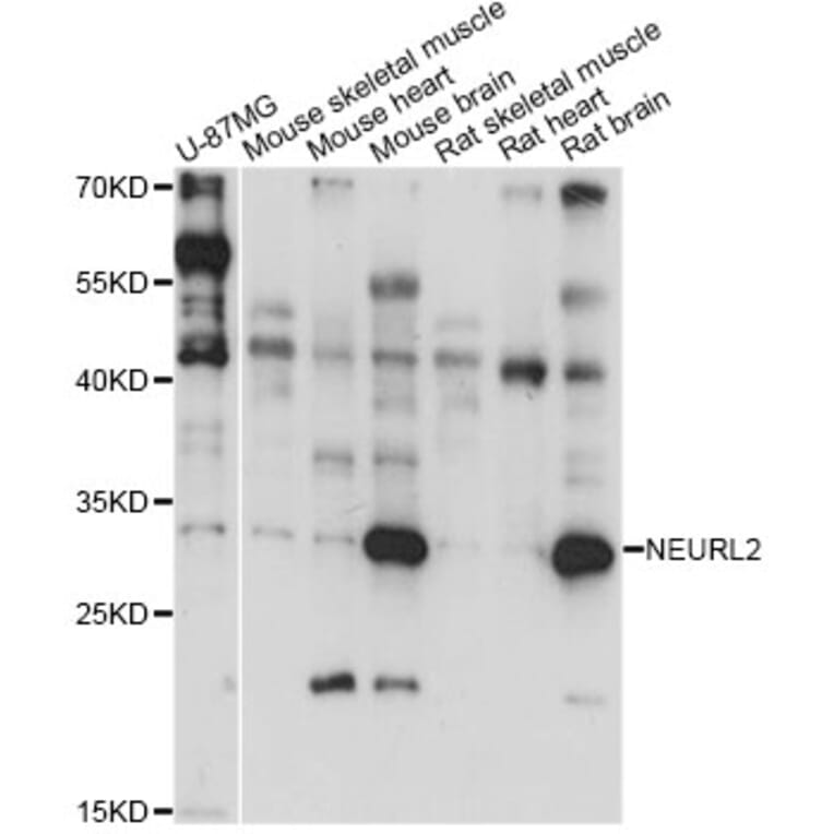 Western Blot - Anti-NEURL2 Antibody (A14450) - Antibodies.com