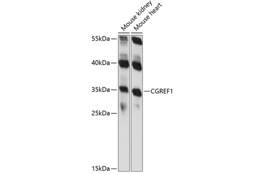 Western Blot - Anti-CGREF1 Antibody (A89249) - Antibodies.com