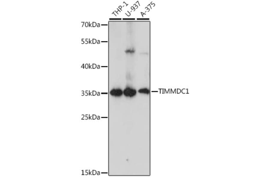 Western Blot - Anti-TIMMDC1/C3orf1 Antibody (A89250) - Antibodies.com