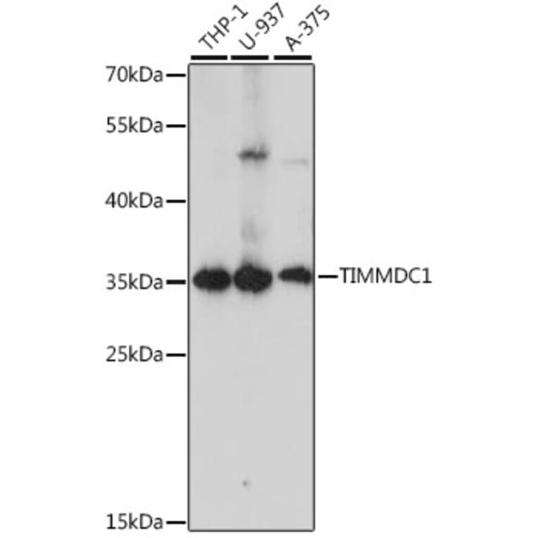 Western Blot - Anti-TIMMDC1/C3orf1 Antibody (A89250) - Antibodies.com