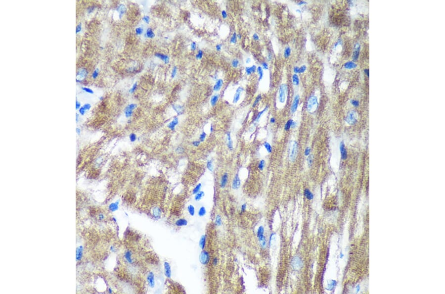 Immunohistochemistry - Anti-TIMMDC1/C3orf1 Antibody (A89250) - Antibodies.com