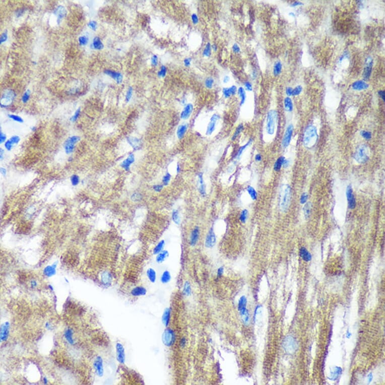 Immunohistochemistry - Anti-TIMMDC1/C3orf1 Antibody (A89250) - Antibodies.com