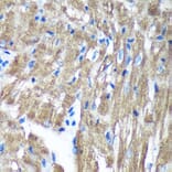 Immunohistochemistry - Anti-TIMMDC1/C3orf1 Antibody (A89250) - Antibodies.com