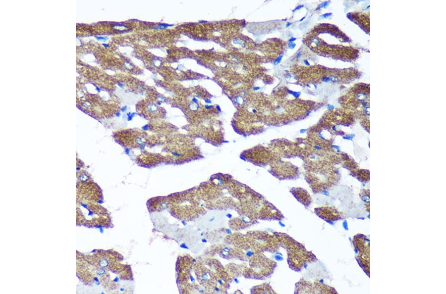 Immunohistochemistry - Anti-TIMMDC1/C3orf1 Antibody (A89250) - Antibodies.com