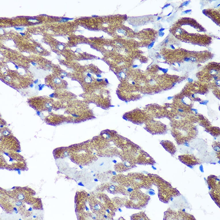 Immunohistochemistry - Anti-TIMMDC1/C3orf1 Antibody (A89250) - Antibodies.com