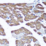 Immunohistochemistry - Anti-TIMMDC1/C3orf1 Antibody (A89250) - Antibodies.com