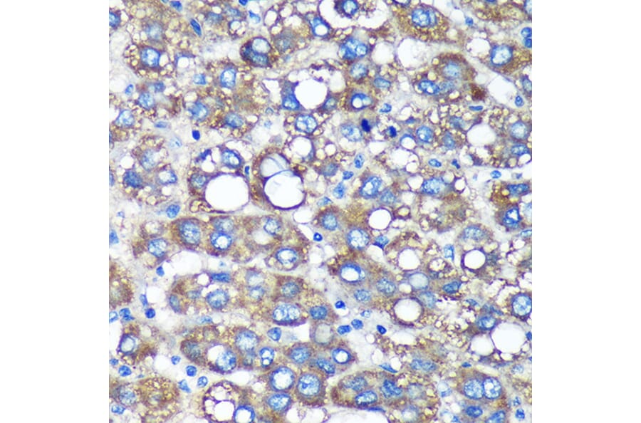 Immunohistochemistry - Anti-TIMMDC1/C3orf1 Antibody (A89250) - Antibodies.com