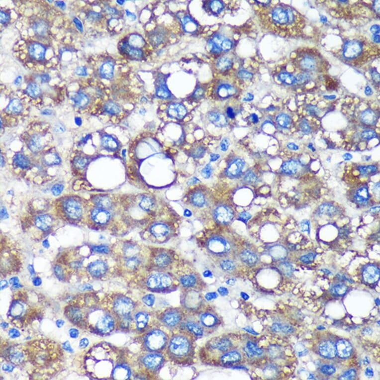 Immunohistochemistry - Anti-TIMMDC1/C3orf1 Antibody (A89250) - Antibodies.com