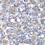 Immunohistochemistry - Anti-TIMMDC1/C3orf1 Antibody (A89250) - Antibodies.com