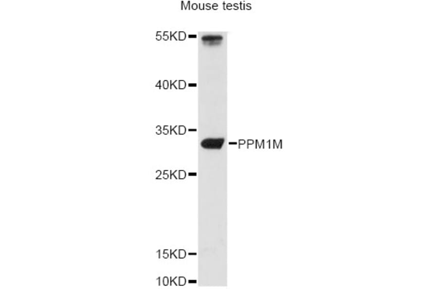 Western Blot - Anti-PPM1M Antibody (A14446) - Antibodies.com