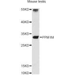 Western Blot - Anti-PPM1M Antibody (A14446) - Antibodies.com