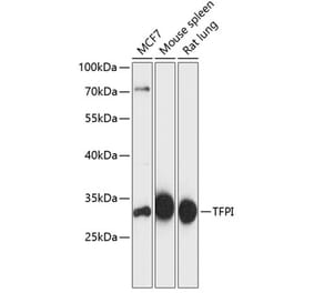 Western Blot - Anti-TFPI Antibody (A89253) - Antibodies.com