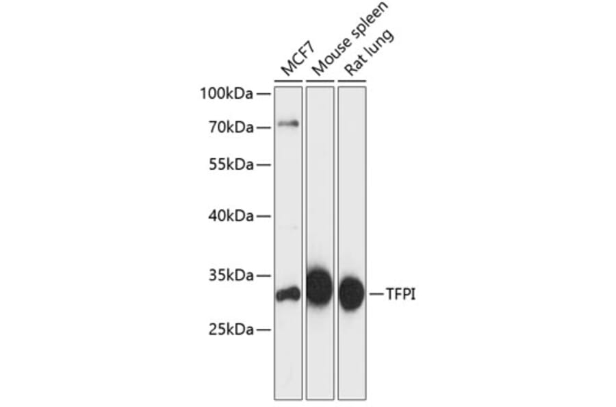 Western Blot - Anti-TFPI Antibody (A89253) - Antibodies.com