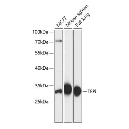 Western Blot - Anti-TFPI Antibody (A89253) - Antibodies.com