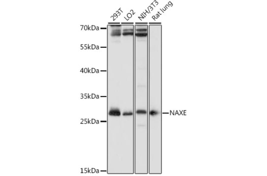 Western Blot - Anti-APOA1BP Antibody (A89254) - Antibodies.com
