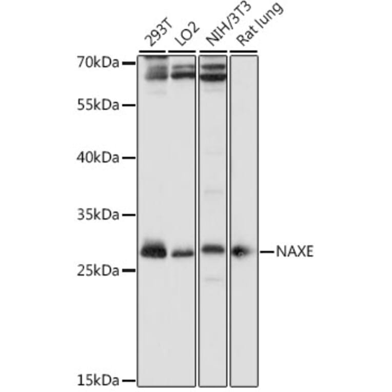 Western Blot - Anti-APOA1BP Antibody (A89254) - Antibodies.com