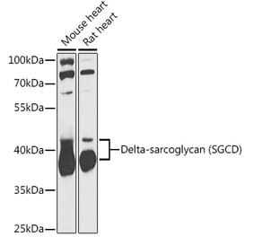 Western Blot - Anti-delta Sarcoglycan Antibody (A89255) - Antibodies.com