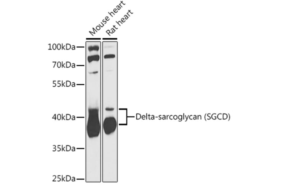 Western Blot - Anti-delta Sarcoglycan Antibody (A89255) - Antibodies.com