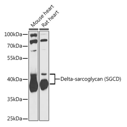 Western Blot - Anti-delta Sarcoglycan Antibody (A89255) - Antibodies.com