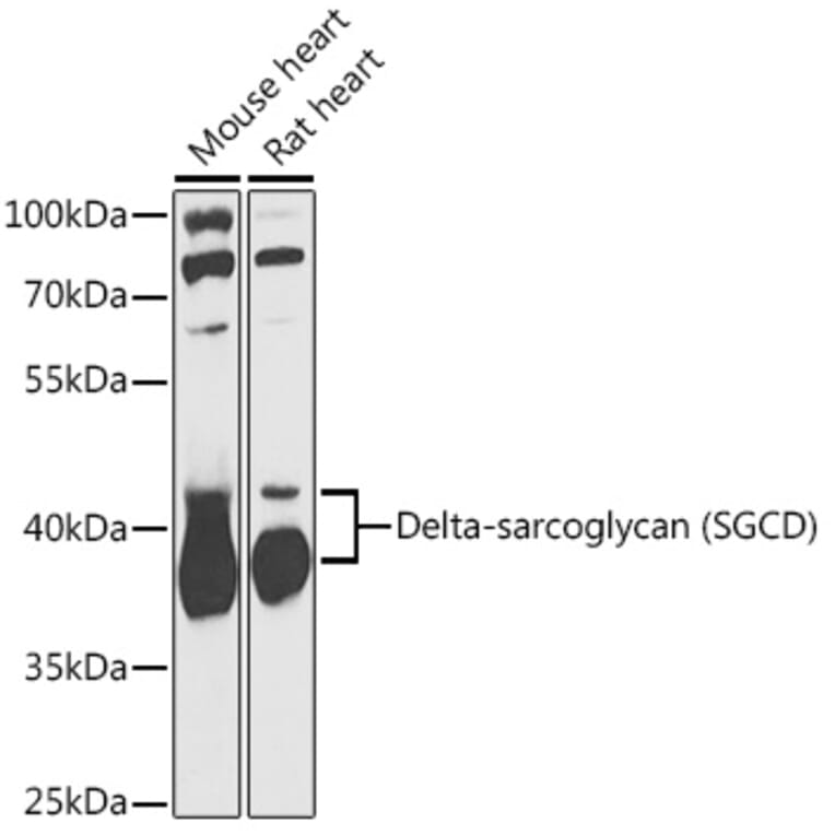 Western Blot - Anti-delta Sarcoglycan Antibody (A89255) - Antibodies.com